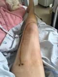 IMG-20160623-WA0003